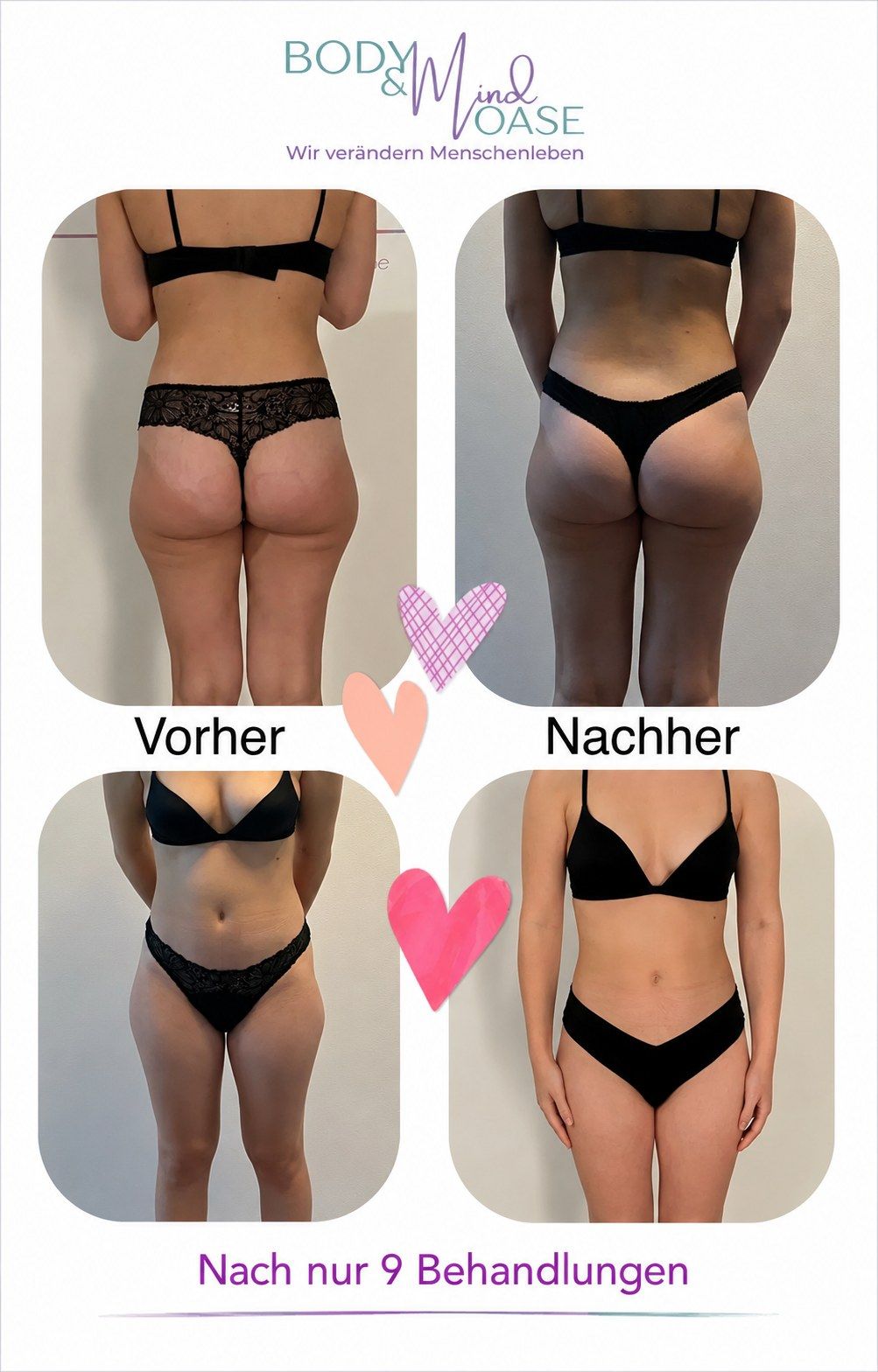 Vorher-Nachher-Dokumentation nach 9 Behandlungen