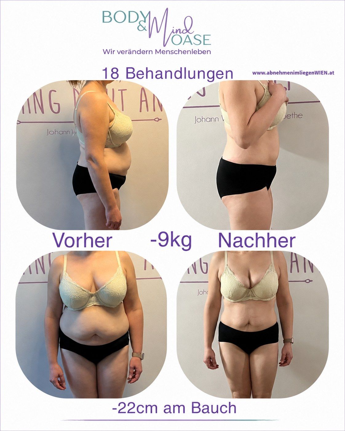 Vorher-Nachher-Dokumentation nach 18 Behandlungen